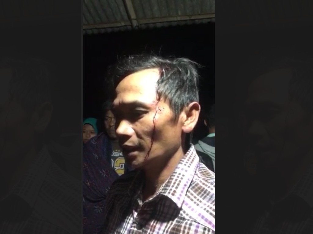 Sejumlah Warga Pakel Banyuwangi Luka-luka Dipukuli Polisi