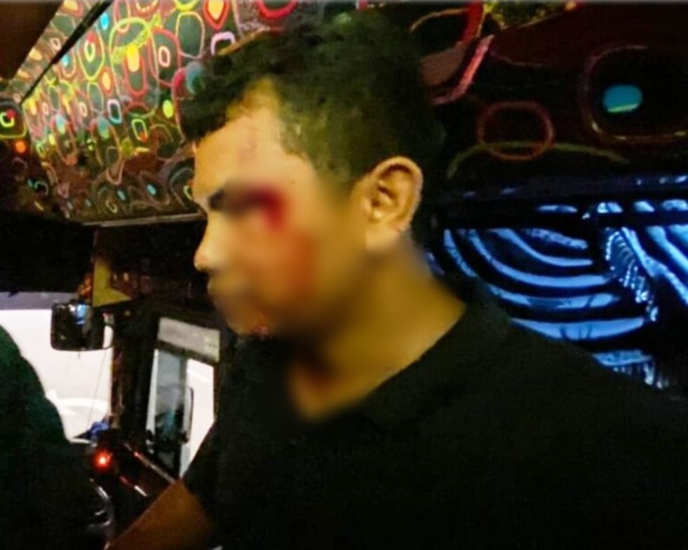 Rombongan Suporter PSM Diserang Suporter Kuala Lumpur FC, Satu Mengalami Luka