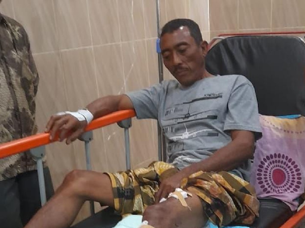 Lolos dari Maut, Eks Kades di Aceh Lepas dari Terkaman Buaya 