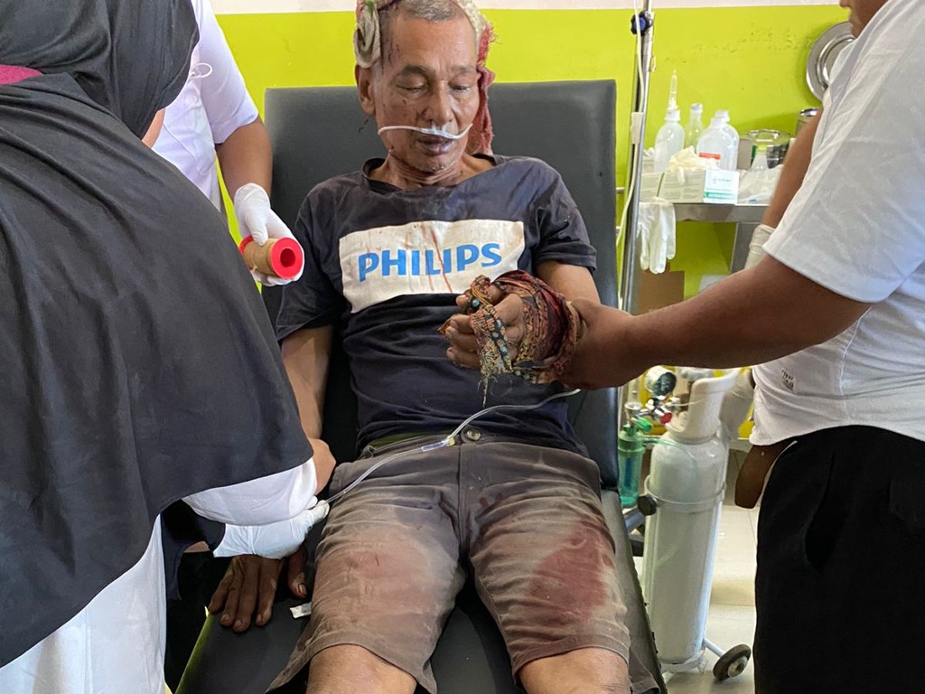 Tiga Warga di Aceh Selatan Diserang Harimau, Dua Kritis Dilarikan ke Rumah Sakit