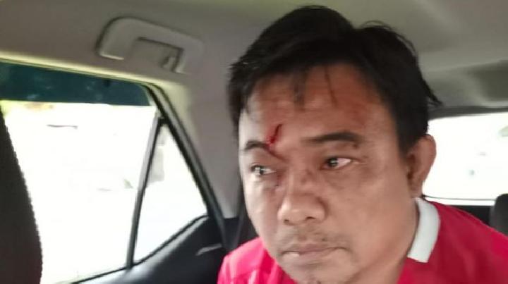 Damai Hari Lubis Minta Polri Ungkap Otak di Balik Pemukulan Haris Pertama