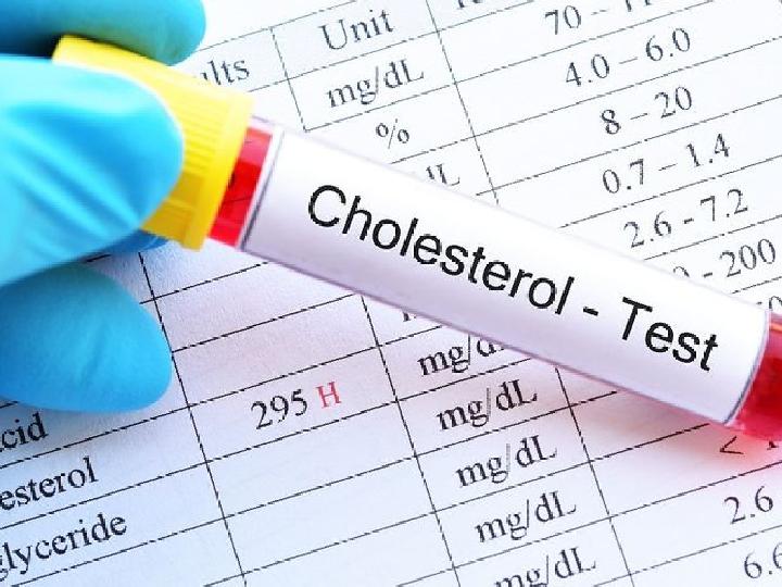 Prof Zubairi Djoerban: Kolesterol Tinggi Itu Bukan Penyakit