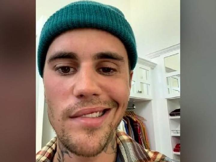 Justin Bieber Wajahnya Lumpuh, Prof Zubairi: Terkena Ramsay Hunt Syndrome