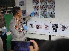 Polrestabes Medan Ungkap Fakta Penganiayaan Berujung Kematian di Percut Sei Tuan