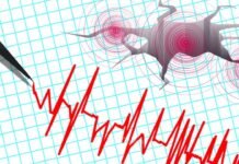 BMKG Beberkan Fakta Wilayah Jember Jawa Timur Rawan Gempa