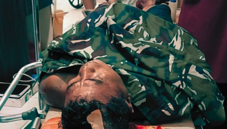 Keluarga Anggota TNI Jadi Korban Penganiayaan Brutal, Polisi Diminta Usut Dalang Penyerangan Anggota TNI